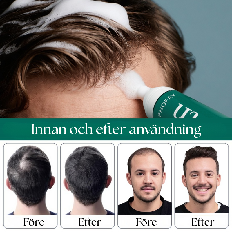 Anti-Hair Loss Mousse, för kvinnor och män